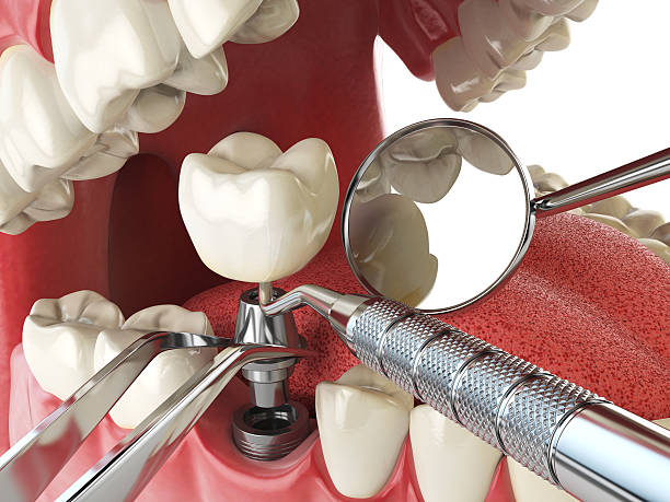 Best Knocked-Out Tooth Emergency  in Hilliard, FL